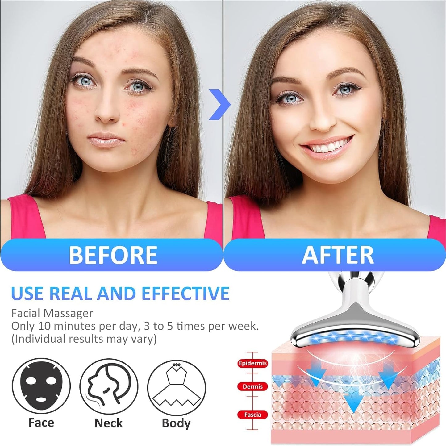 Anti Wrinkle Beauty Apparatus